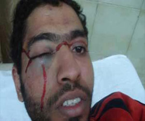   مصر اليوم - الاعتداء على الناشط عبد الرحمن عز ونقله إلى مستشفى الهلال الأحمر