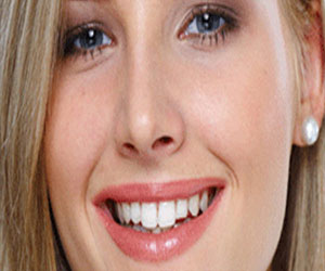   مصر اليوم - اهتمام الحوامل بصحة الأسنان يجنبهن الولادة المبكرة