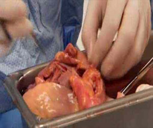   مصر اليوم - التحقيق في قضية تجارة أعضاء في الإسكندرية