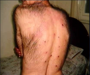   مصر اليوم - حقوقيون يتقدمون ببلاغ ضد وزير الداخلية في واقعة هتك عرض محبوسين