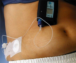   مصر اليوم - دهون الكبد قد تتسبب في مقاومة الجسم للأنسولين