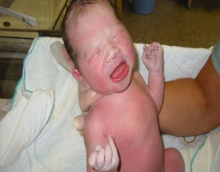   مصر اليوم - أرجنتينية زُرع لها قلب قبل 13 عامًا تلد طفل أنابيب