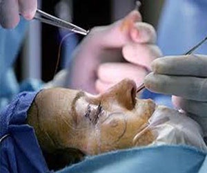   مصر اليوم - 15 مليون شخص حول العالم خضعوا لجراحة تجميل