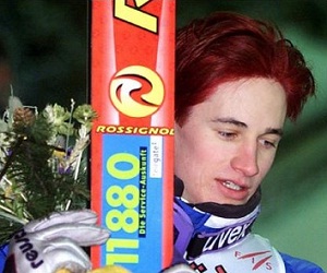   مصر اليوم - إختبار لإنجاب أطفال بشعر أحمر