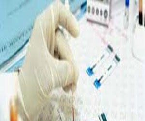   مصر اليوم - تحذيرات من استخدام عقاقير رخيصة أقل فعالية لعلاج الإيدز