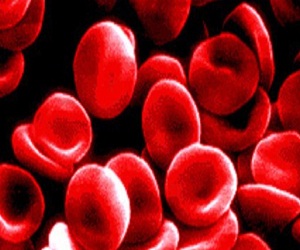   مصر اليوم - فصيلة الدم تلعب دورًا في الإصابة بالجلطات