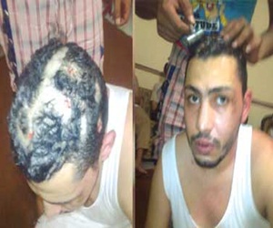   مصر اليوم - مركز علاج الإدمان في المقطم غير مقيد في سجلات الصحة النفسية