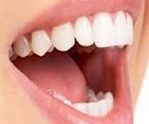   مصر اليوم - مادة جديدة تجعل الأسنان مضادة للتسوس