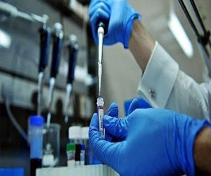   مصر اليوم - الدواء الأميركية تصدق على إنتاج دوكسيل المعالج للسرطان