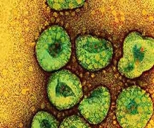   مصر اليوم - حالة إصابة جديدة بفيروس إكليلي تظهر إنتقاله بالعدوى