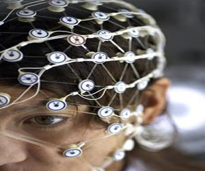   مصر اليوم - الإثارة العميقة للمخ قد تساعد مرضى الشلل الرعاش