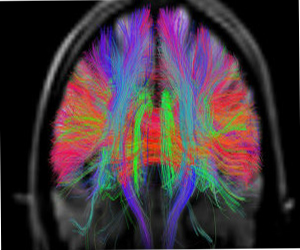   مصر اليوم - علماء أميركيون يكتشفون شبكة معقدة من الوصلات في الدماغ البشري