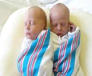   مصر اليوم - حمل طبيعي نتيجته زوجان من التوائم المتطابقين