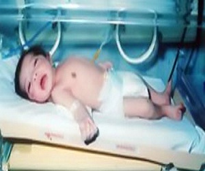   مصر اليوم - تحذير من مخاطر عدم إرضاع الأطفال