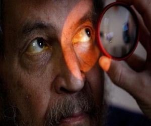   مصر اليوم - 60 ألف مصاب بالماء الأبيض في السعودية