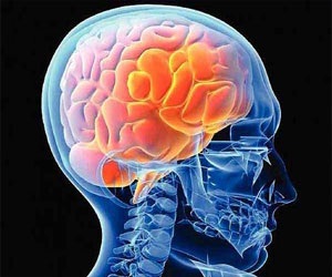   مصر اليوم - انخفاض الرغبة الجنسية لدى الرجال تأتي من المخ