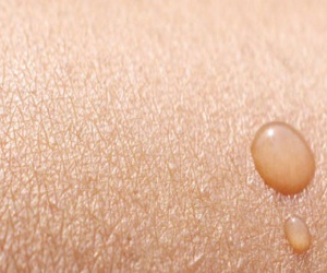   مصر اليوم - مضاد حيوي في العرق يكافح جراثيم المستشفيات