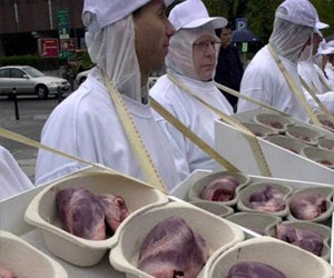   مصر اليوم - مرض غوشيه يصيب أعضاء وأنسجة الجسم المختلفة