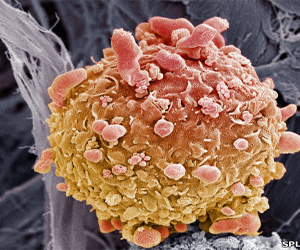   مصر اليوم - سرطان الجلد قادر على مقاومة جهاز الجسم المناعي