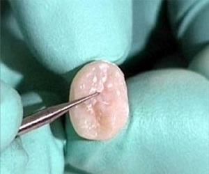   مصر اليوم - الفحص الدوري مهم لمكافحة حساسية الأسنان