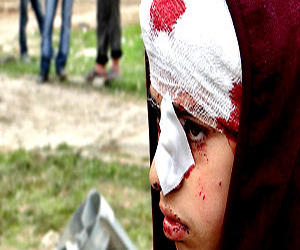   مصر اليوم - أطباء بلا حدود: النظام الصحي السوري انهار