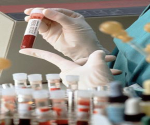   مصر اليوم - الصحة: إطلاق مبادرة لرصد الأمراض غير المعدية