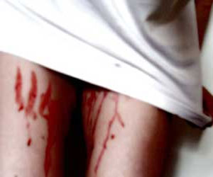   مصر اليوم - بريطانية تلقي بنفسها من نافذة فندق في الهند هربًا من الإعتداء الجنسي عليها