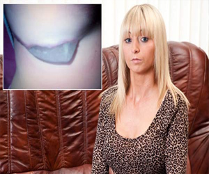   مصر اليوم - ثدي شابة بريطانية يرفض عملية التكبير