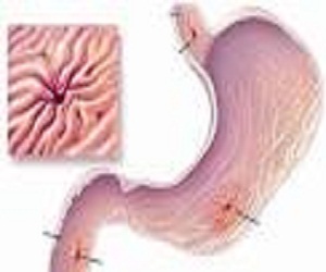   مصر اليوم - اختبار بسيط للتنفّس للتنبؤ بخطر الإصابة بزيادة في الوزن