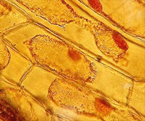   مصر اليوم - نقص إنزيم معين في الجسم يحول الخلايا الدهنية إلى خلايا حارقة للطاقة