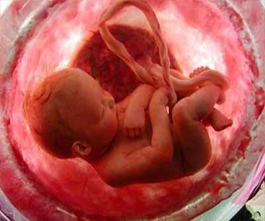   مصر اليوم - علاج الأمراض المعوية بالخلايا الجذعية حول الجنين