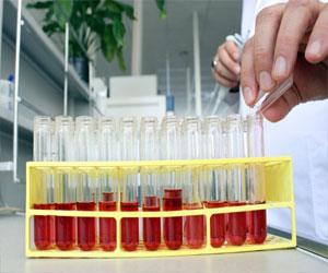   مصر اليوم - دراسة: ارتفاع معدلات الشفاء من السرطان في أميركا