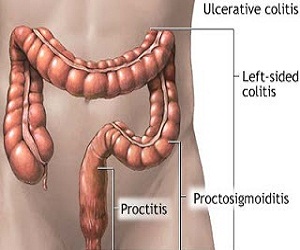   مصر اليوم - فائدة التدخين الوحيدة المثبتة علميًا