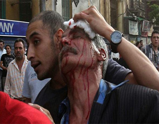   مصر اليوم - واشنطن تدين العنف الطائفي في مصر وترحب بوعد مرسي بالتحقيق