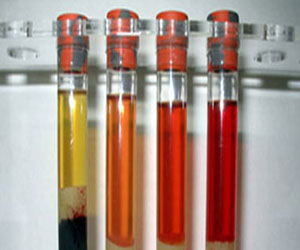   مصر اليوم - الصين تجري أبحاثا لتطوير لقاح فيروس إتش 7 أن 9