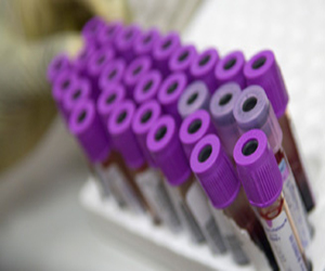   مصر اليوم - إتفاق صيني عربي للتعاون في مجال الدواء ومكافحة الأمراض