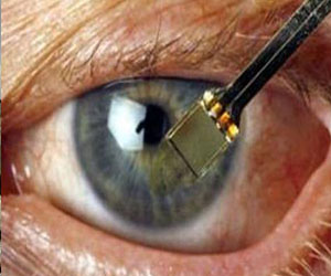   مصر اليوم - كردستان: إصابة 30 شخصًا بالعمى إثر خطأ طبي