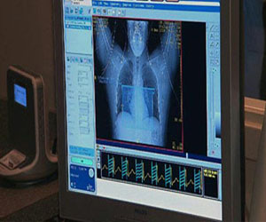   مصر اليوم - 3 أمور يجب معرفتها عن النوبات القلبية