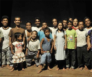   مصر اليوم - يونيسيف: بالإمكان مكافحة مرض تقزم الأطفال