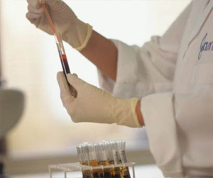   مصر اليوم - سجن عالم بريطاني لتزويره نتائج اختبار على عقار لعلاج السرطان