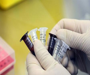   مصر اليوم - شفاء مصابة بفيروس إتش7 إن 9 شرقي الصين