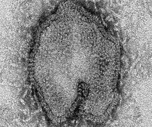   مصر اليوم - عدد وفيات انفلونزا الطيور في الصين يرتفع الى 20