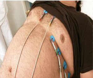   مصر اليوم - مانشيستر عاصمة أمراض القلب في بريطانيا