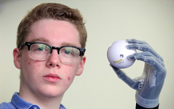   مصر اليوم - أول مستخدم لليد التعويضية الذكية من بريطانيا سعيد بإمكاناتها المتطورة