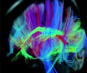 مصر اليوم - مخ الاطفال يتشكل داخل الرحم وعقب الولاد