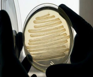 مصر اليوم - نوع من البكتريا ينتج وقودًا حيويًا شبيها بالديزل