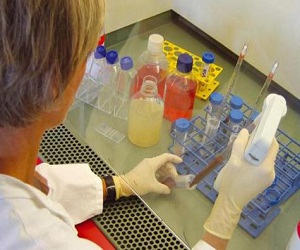   مصر اليوم - فيروس الكبد الوبائي عمره ملايين السنين