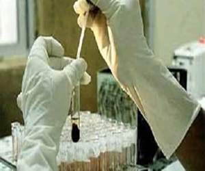   مصر اليوم - السعودية تعلن وفاة 5 مواطنين بفيروس كورونا