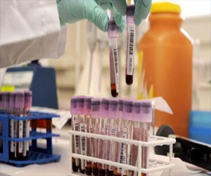   مصر اليوم - الاتحاد الألماني يرحب بالكشف عن المنشطات في الدم