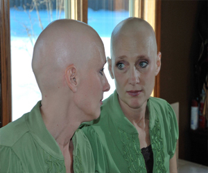   مصر اليوم - مرضى السرطان في بريطانيا يعانون من التمييز في العمل